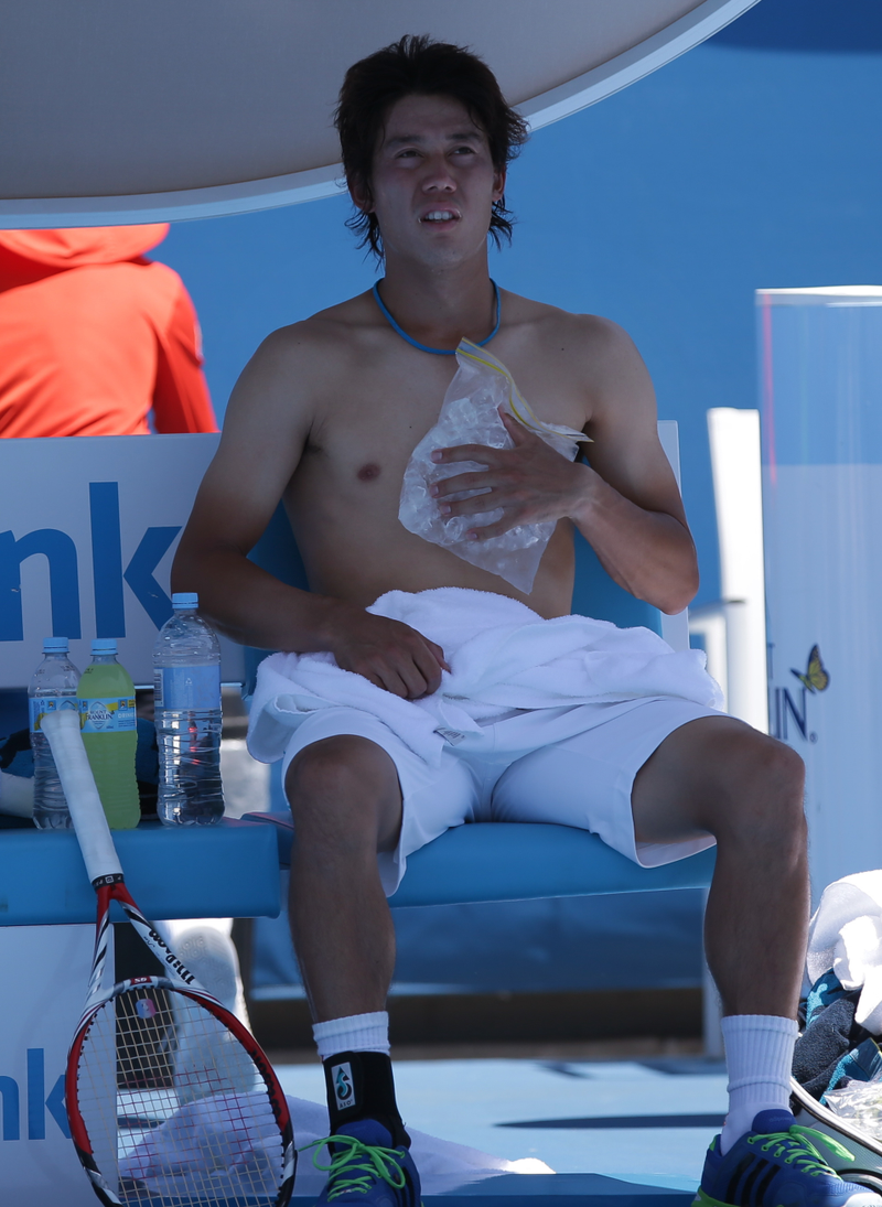 Illustration for article titled Players Are Fainting, Puking, And Hallucinating At The Australian Open